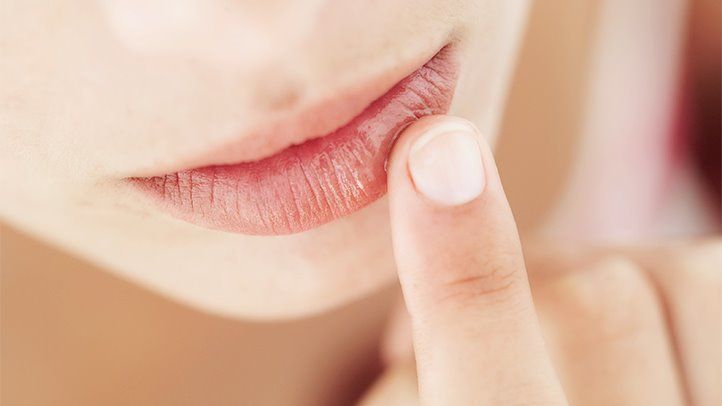 Почему трескаются губы – 10 причин и что делать