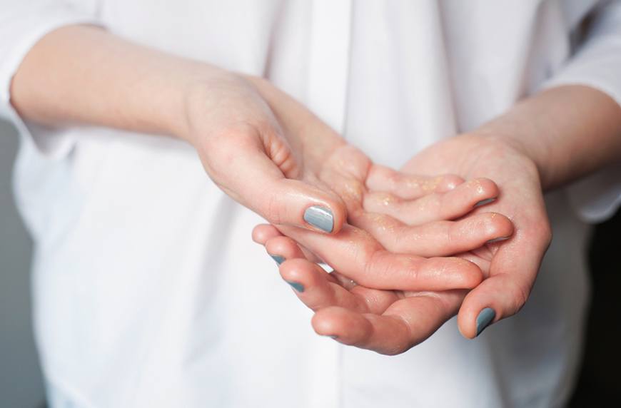 Сухая кожа на пальцах рук: причины сухости на кончиках и подушечках пальцев рук, что делать