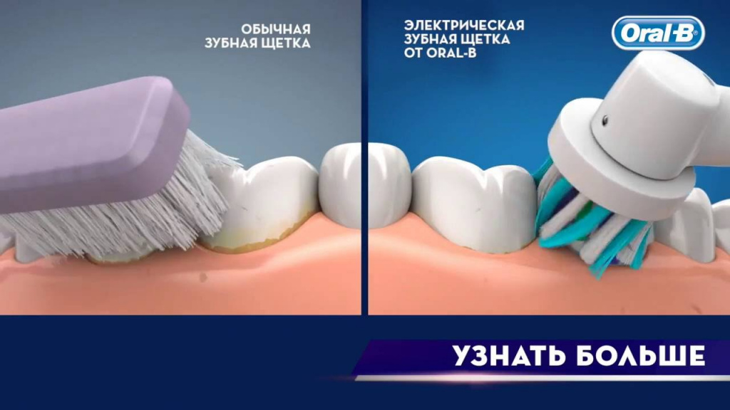 Как выбрать электрическую зубную щетку – отзывы стоматологов - журнал