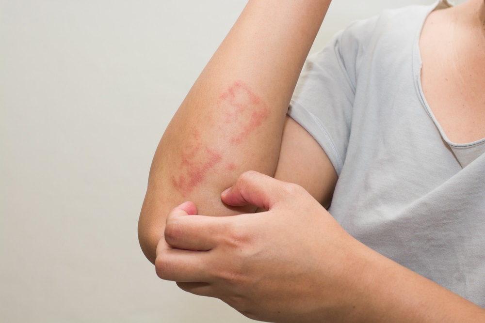 Шелушение кожи на теле: причин и лечебных средств